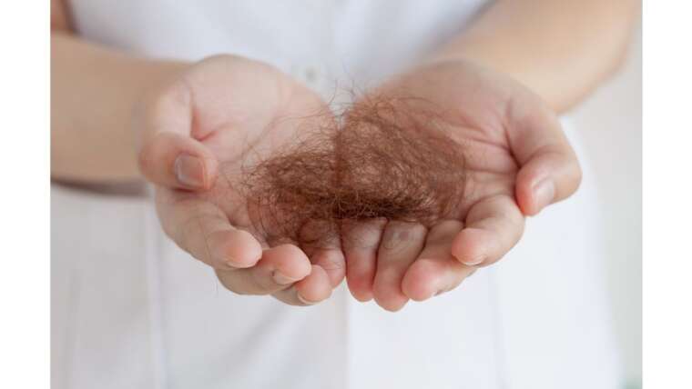 Ômega 3 ajuda na queda de cabelo: entenda este benefício
